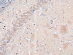 NSE Antibody in Immunohistochemistry (Paraffin) (IHC (P))