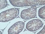 NSE Antibody in Immunohistochemistry (Paraffin) (IHC (P))