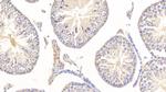 NSE Antibody in Immunohistochemistry (Paraffin) (IHC (P))