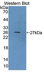 eIF2d Antibody in Western Blot (WB)