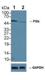 Fibrinogen Beta Chain Antibody in Western Blot (WB)