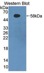 Fibrinogen Beta Chain Antibody in Western Blot (WB)