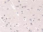 FKBP4 Antibody in Immunohistochemistry (Paraffin) (IHC (P))