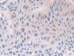 FKBP4 Antibody in Immunohistochemistry (Paraffin) (IHC (P))