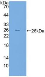 FKBP7 Antibody in Western Blot (WB)