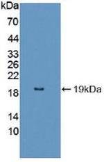 Fumarase Antibody in Western Blot (WB)