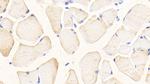 Glutaminase Antibody in Immunohistochemistry (Paraffin) (IHC (P))