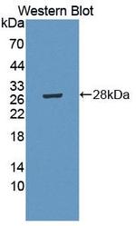 Glutaminase Antibody in Western Blot (WB)