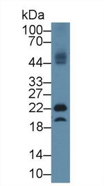 GPX4 Antibody in Western Blot (WB)