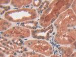 PYGL Antibody in Immunohistochemistry (Paraffin) (IHC (P))