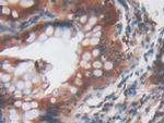 PYGL Antibody in Immunohistochemistry (Paraffin) (IHC (P))