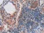 PYGL Antibody in Immunohistochemistry (Paraffin) (IHC (P))