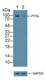 PYGL Antibody in Western Blot (WB)