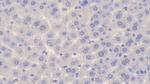 PYGM Antibody in Immunohistochemistry (Paraffin) (IHC (P))