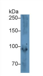 PYGM Antibody in Western Blot (WB)