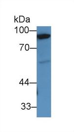 PYGM Antibody in Western Blot (WB)