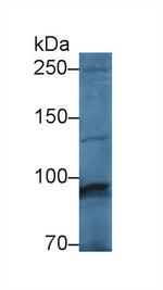 PYGM Antibody in Western Blot (WB)