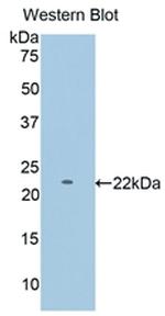 PYGM Antibody in Western Blot (WB)