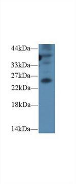 GREM1 Antibody in Western Blot (WB)