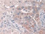 GRB10 Antibody in Immunohistochemistry (Paraffin) (IHC (P))