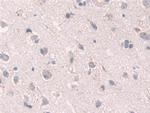 GRB10 Antibody in Immunohistochemistry (Paraffin) (IHC (P))