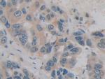 Histone Macro-H2A.1 Antibody in Immunohistochemistry (Paraffin) (IHC (P))