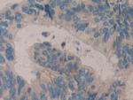 Histone Macro-H2A.1 Antibody in Immunohistochemistry (Paraffin) (IHC (P))