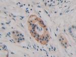 Histone Macro-H2A.1 Antibody in Immunohistochemistry (Paraffin) (IHC (P))