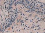 Histone Macro-H2A.1 Antibody in Immunohistochemistry (Paraffin) (IHC (P))