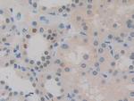 Histone Macro-H2A.1 Antibody in Immunohistochemistry (Paraffin) (IHC (P))