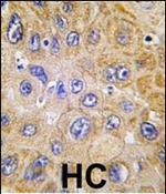 CD90 Antibody in Immunohistochemistry (Paraffin) (IHC (P))