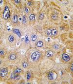 CD90 Antibody in Immunohistochemistry (Paraffin) (IHC (P))