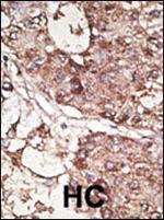 CD90 Antibody in Immunohistochemistry (Paraffin) (IHC (P))