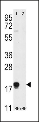 CD90 Antibody in Western Blot (WB)