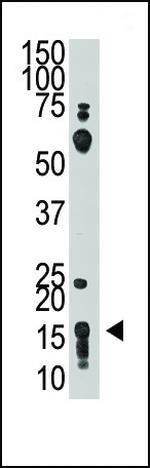 CD90 Antibody in Western Blot (WB)