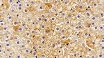 Haptoglobin Antibody in Immunohistochemistry (Paraffin) (IHC (P))