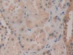 HSPA1A Antibody in Immunohistochemistry (Paraffin) (IHC (P))