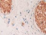 HBD Antibody in Immunohistochemistry (Paraffin) (IHC (P))