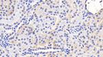 HFE2 Antibody in Immunohistochemistry (Paraffin) (IHC (P))