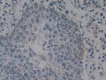 HMGB1 Antibody in Immunohistochemistry (Paraffin) (IHC (P))