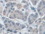 IDE Antibody in Immunohistochemistry (Paraffin) (IHC (P))