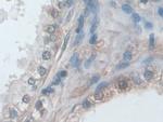 IDE Antibody in Immunohistochemistry (Paraffin) (IHC (P))