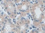 IDE Antibody in Immunohistochemistry (Paraffin) (IHC (P))