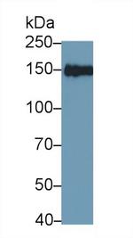 IRS2 Antibody in Western Blot (WB)