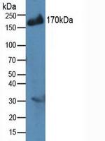 IRS2 Antibody in Western Blot (WB)