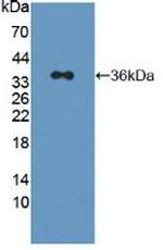 IRS2 Antibody in Western Blot (WB)