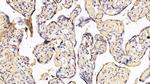 IFNAR2 Antibody in Immunohistochemistry (Paraffin) (IHC (P))