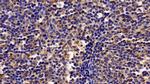 IFNAR2 Antibody in Immunohistochemistry (Paraffin) (IHC (P))