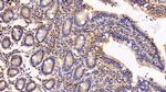 IFNAR2 Antibody in Immunohistochemistry (Paraffin) (IHC (P))