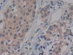 IFNAR2 Antibody in Immunohistochemistry (Paraffin) (IHC (P))